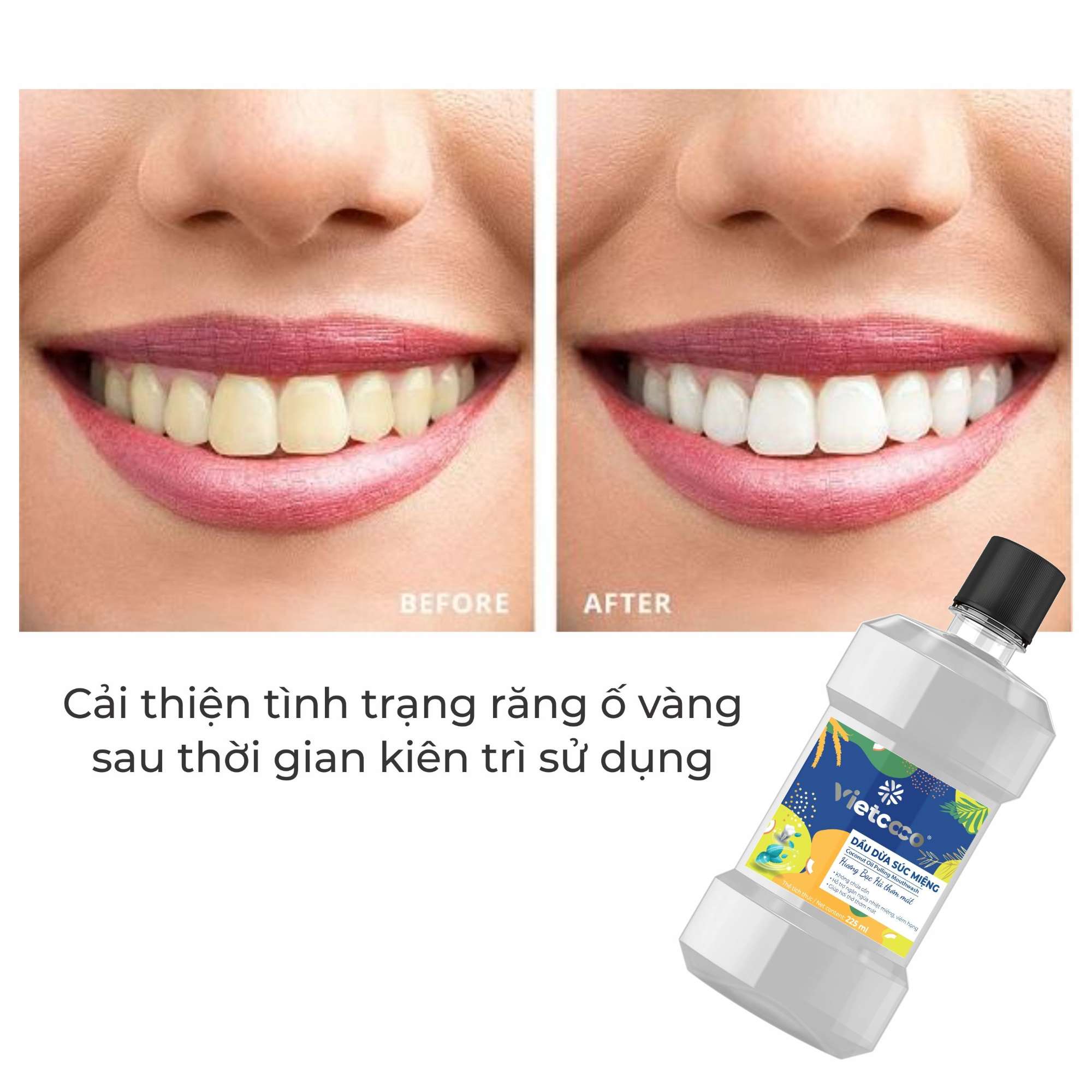 Vietcoco Coconut oil pulling mouthwash